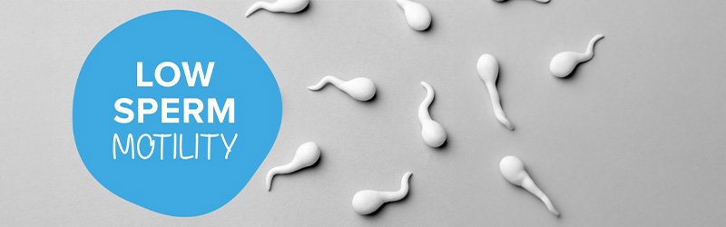 Medical illustration representing reduced sperm motility