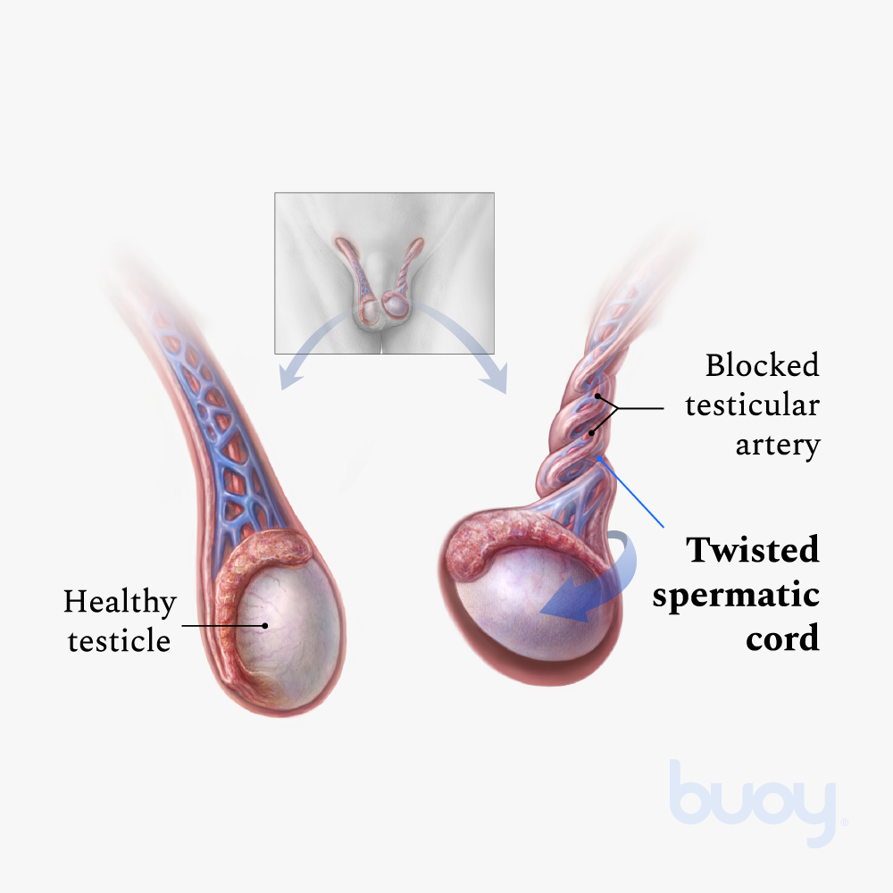 Men's reproductive health illustration